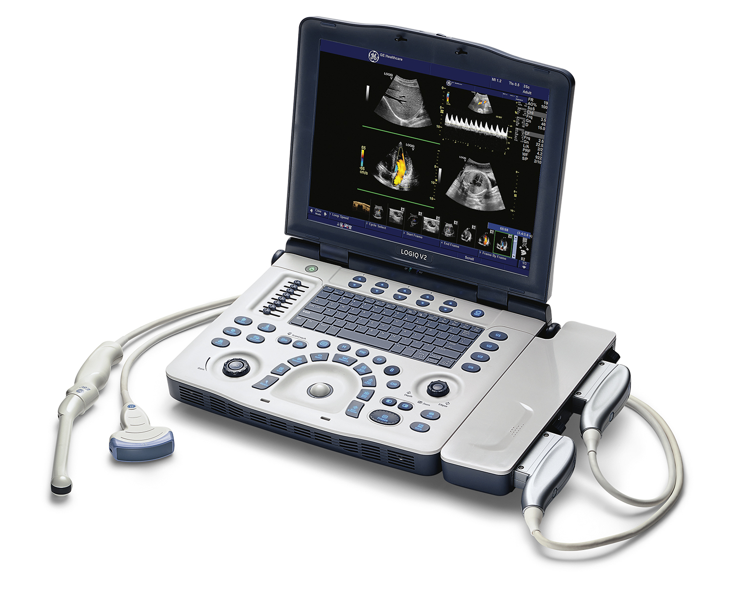 Logiq V2 Ultrasound User Manual